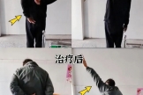 无痛松解肩关节，重获肩部自由