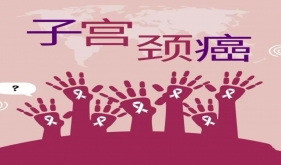 【切勿错过】宫颈癌筛查项目五折优惠活动来啦！