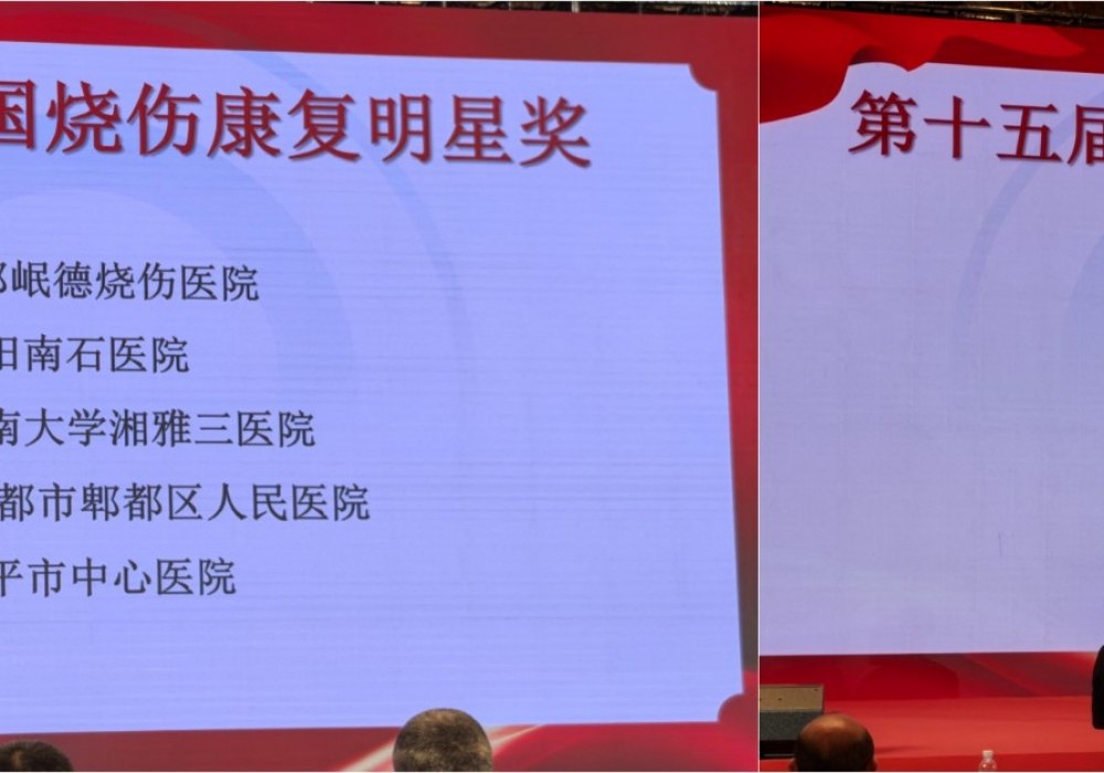 泪目！85%特大面积特重度烧伤患者重生，开平市中心医院烧伤整形美容与创面修复科用爱与责任捧回全国大奖！