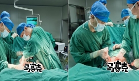 【胸外科专科能力报道:告别“塌陷”的胸膛，重塑“挺立”人生】开平市中心医院胸外科成功完成江门首例成人漏斗胸矫治术