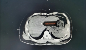 合作共建初显效，危重患者得救治